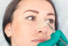 کندن چسب بینی