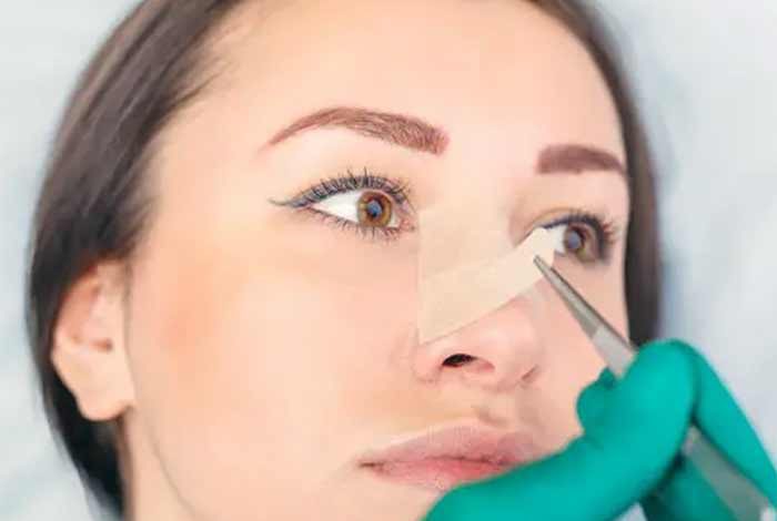 چسب بینی کندن چسب بینی