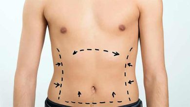 10 برترین انواع عمل زیبایی بدن در ایران و جهان+ عکس