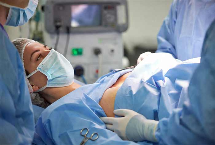 پروتز سینه (Breast Augmentation)