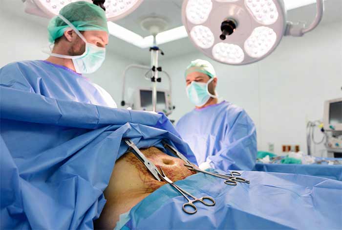 تامی تاک (Tummy Tuck - Abdominoplasty)