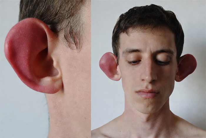 گوش‌های برجسته یا خیلی بزرگ