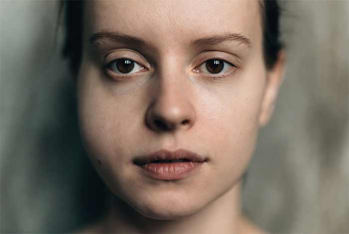 عدم تقارن قابل توجه صورت