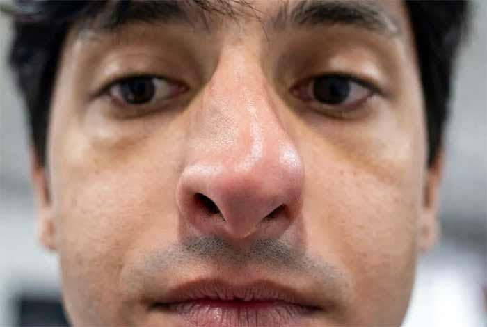 بینی نامتناسب یا خیلی بزرگ