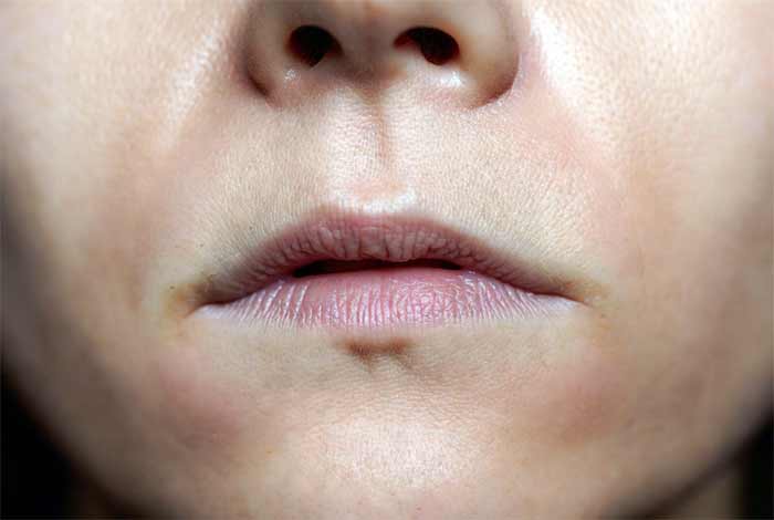 لب‌های بسیار نازک یا نامتعادل