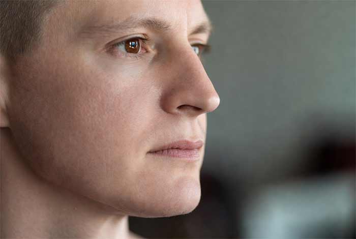 فک ضعیف یا چانه خیلی کوچک